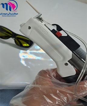 سری دستگاه لیزر موهای زائد